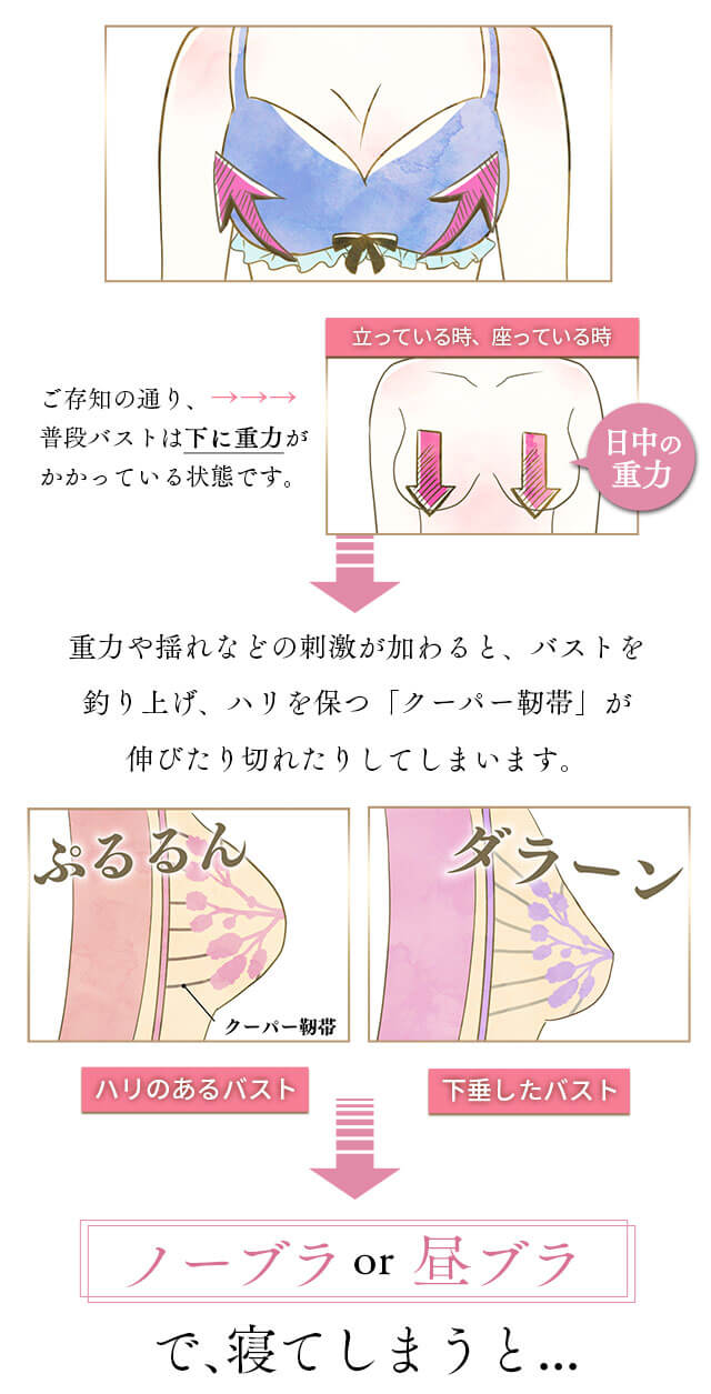 クーパー靭帯